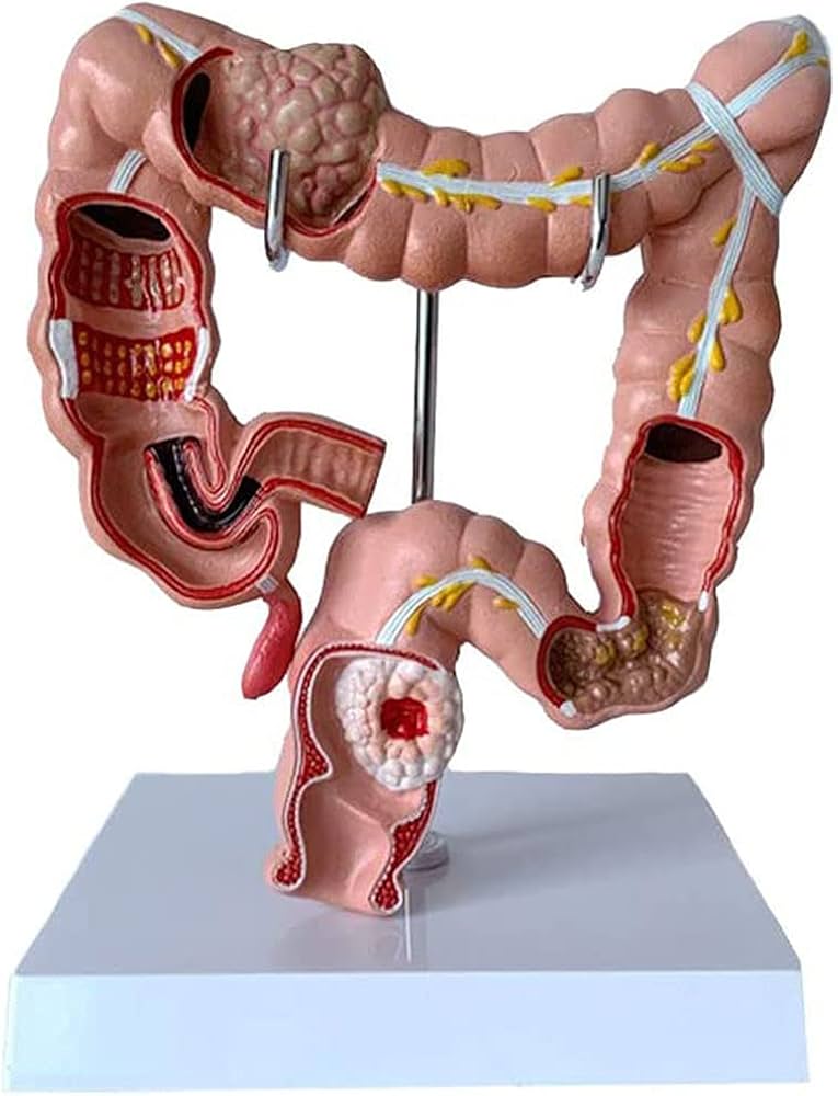 61giVeoGD7S._AC_UF10001000_QL80_-5